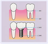 �C���v�����g